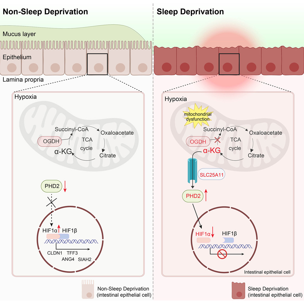 La Disrupción Metabólica y el Daño Intestinal Durante la Privación de Sueño