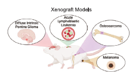 Más Allá del Cáncer: La Terapia CAR-T Podría Dejar una “Niebla Cerebral” Persistente, Pero Hay Esperanza para Revertirla