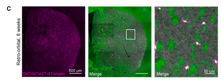 ¡Nuevas Llaves Maestras para el Cerebro! Crean Herramientas Genéticas de Alta Precisión para Estudiar y Manipular Neuronas Específicas
