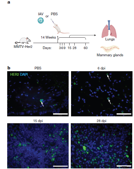 La Alarma Silenciosa: Infecciones Respiratorias como la Gripe y el COVID-19 Pueden “Despertar” Células Cancerosas Latentes y Acelerar la Metástasis