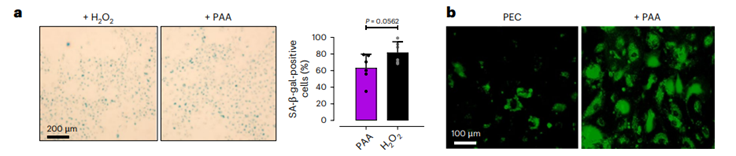 La Conexión Inesperada: Cómo las Bacterias Intestinales Envejecen Nuestras Arterias (y Cómo el Acetato Podría Revertirlo)