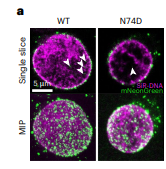 Filmando el Gran Escape: Científicos Capturan en 3D Cómo el VIH Invade el Núcleo Celular y Revelan sus Puntos Débiles
