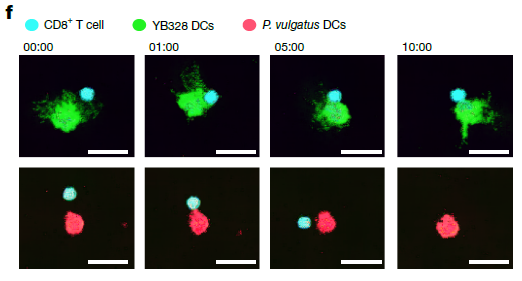 La Conexión Intestino-Tumor: Descubren Cómo una Bacteria Intestinal Dirige a las Células Inmunitarias para Potenciar la Inmunoterapia Contra el Cáncer