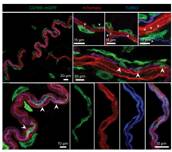 Los Guardianes de la Grasa: Cómo unas células inmunes que ‘patrullan’ nuestros nervios combaten el envejecimiento