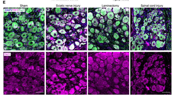 🍬 Dulce Regeneración: La vía de las pentosas fosfato es el “interruptor metabólico” para reparar la médula espinal