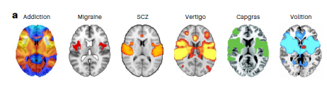 🧭 ¿Un error en el mapa del cerebro? Por qué muchos diagnósticos psiquiátricos podrían ser un “espejismo”