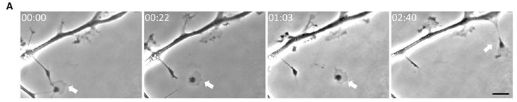 🧟‍♂️ Zombosomas: Los mensajeros “sin cabeza” que propagan enfermedades en el cerebro